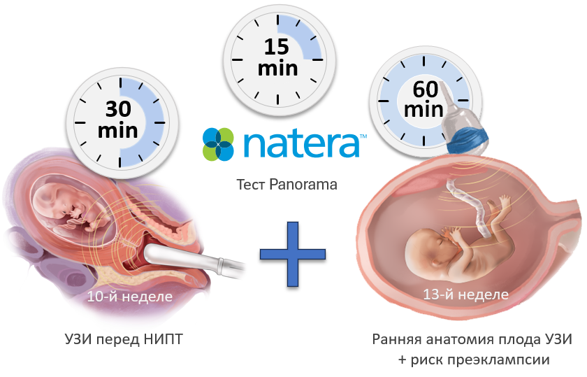 Tест Panorama + Tест OSCAR