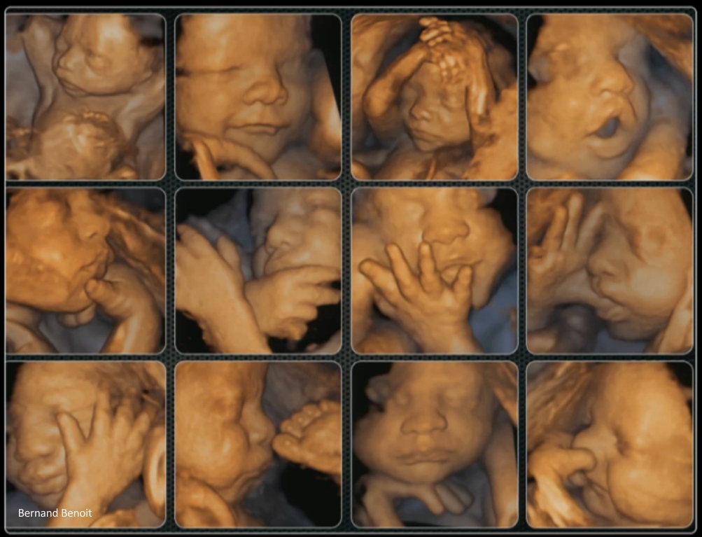 Эти дети родились преждевременно — 41 фотография